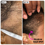 Hollywood Hair Bar Super Grow Scalp Balm - 4 oz Vegan Cruelty-Free Adult Natural Haircare Formula, Revitalizing Scalp Cream, Hydrating Moisturizer Hair Treatment